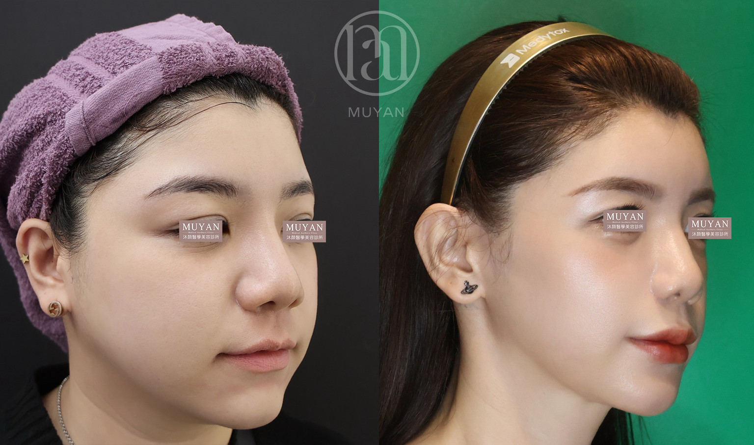 全輪廓整合設計 分享照片 1