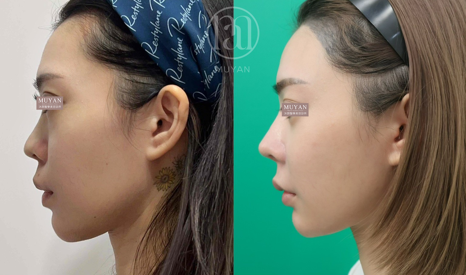 全輪廓整合設計 分享照片 4