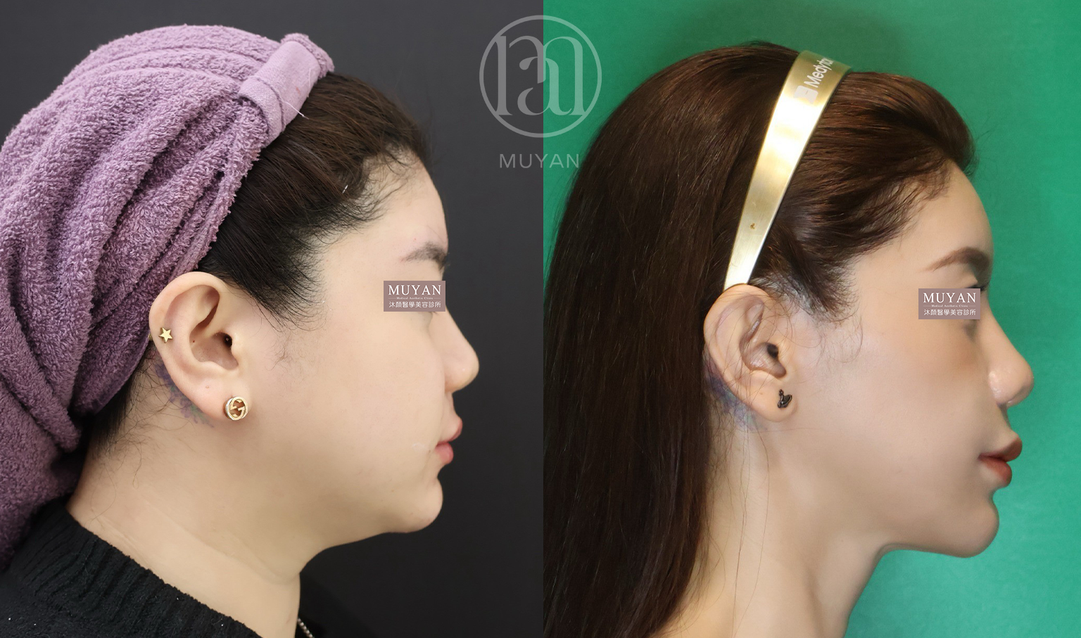 全輪廓整合設計 分享照片 5