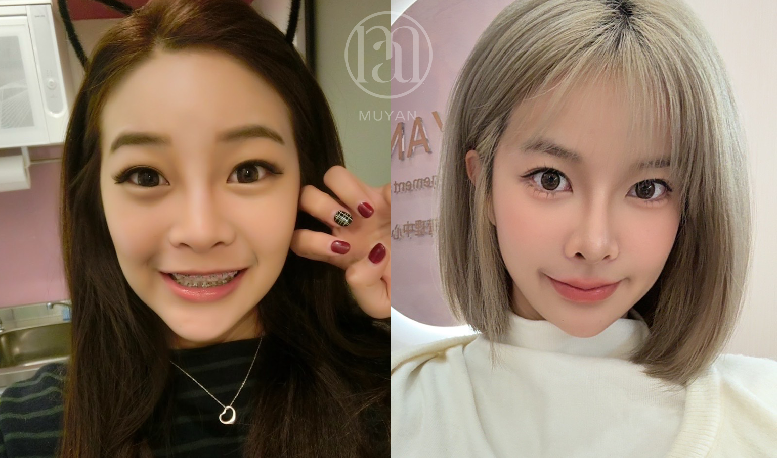 全輪廓整合設計 分享照片 6