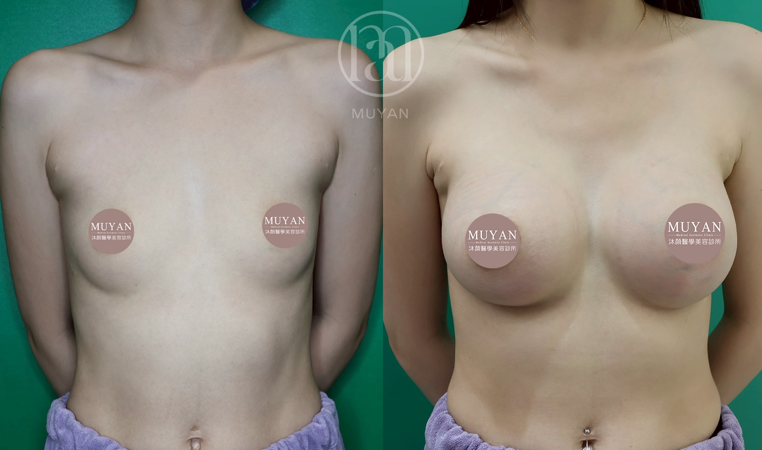 曼陀女王波隆乳 分享照片 2