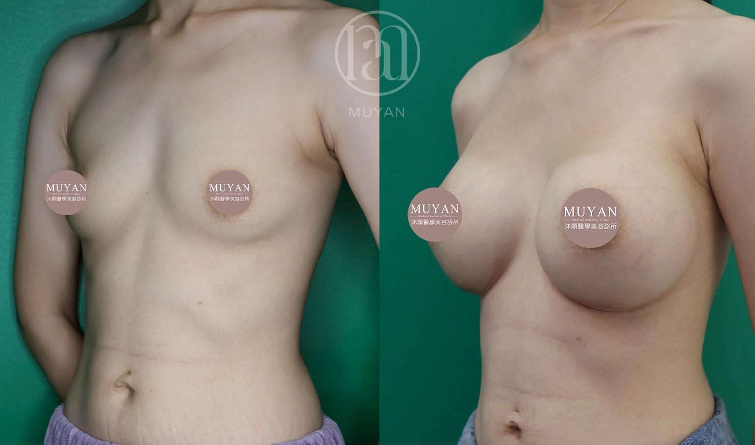 曼陀女王波隆乳 分享照片 3