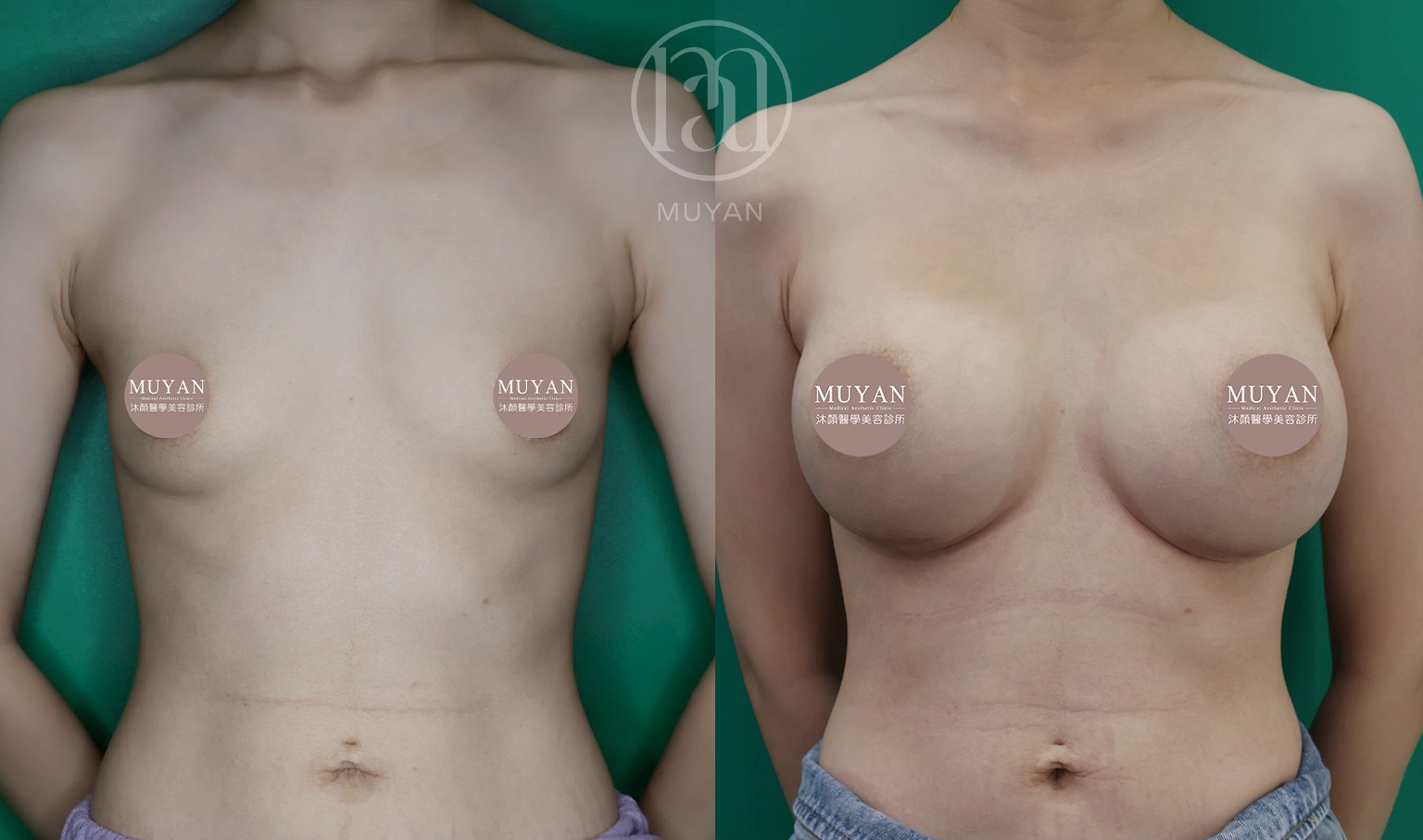 曼陀女王波隆乳 分享照片 4