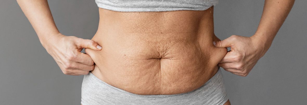 腹直肌鬆弛外凸