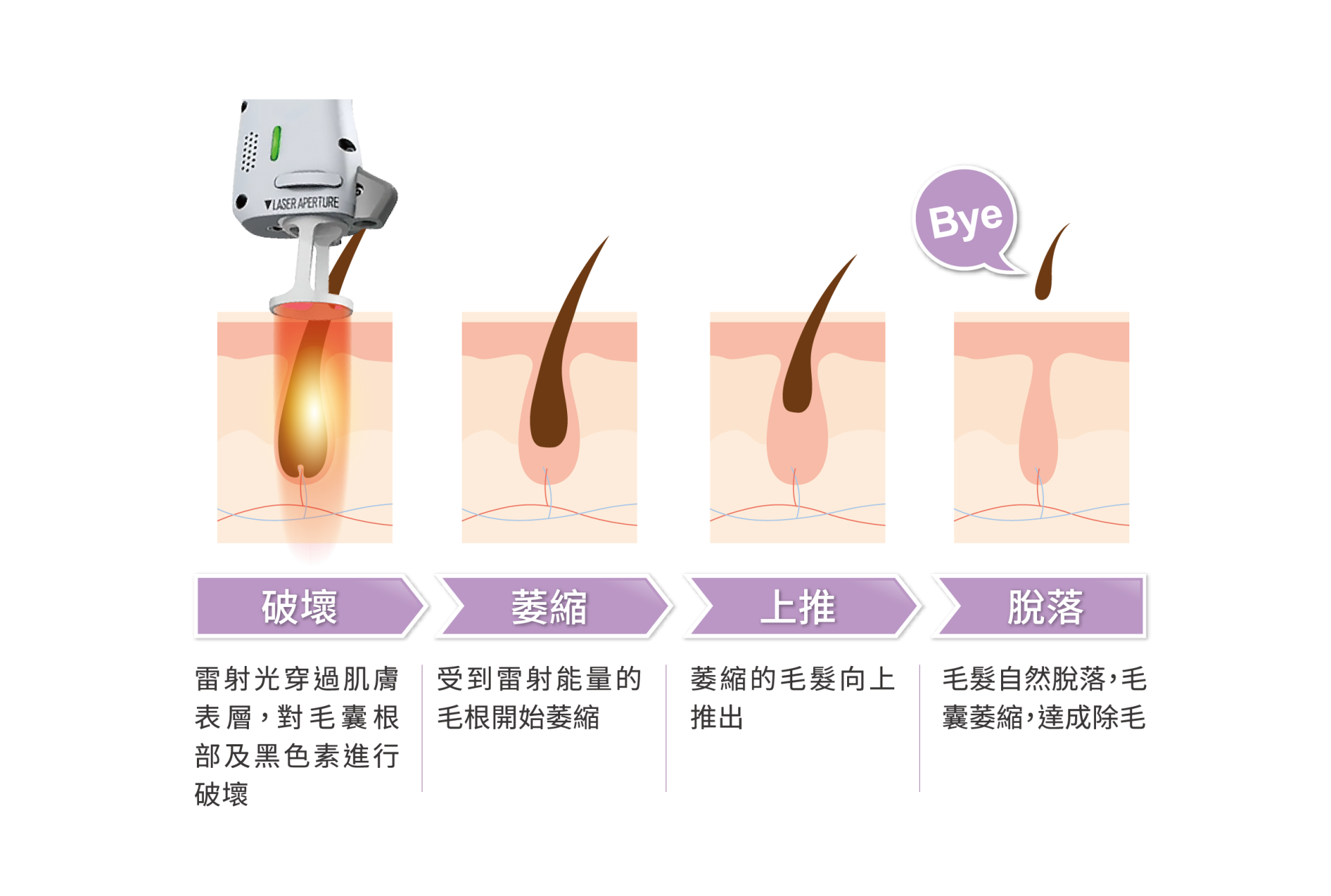 Clarity II克萊媞雷射2.0｜一機多功能｜全面性治療