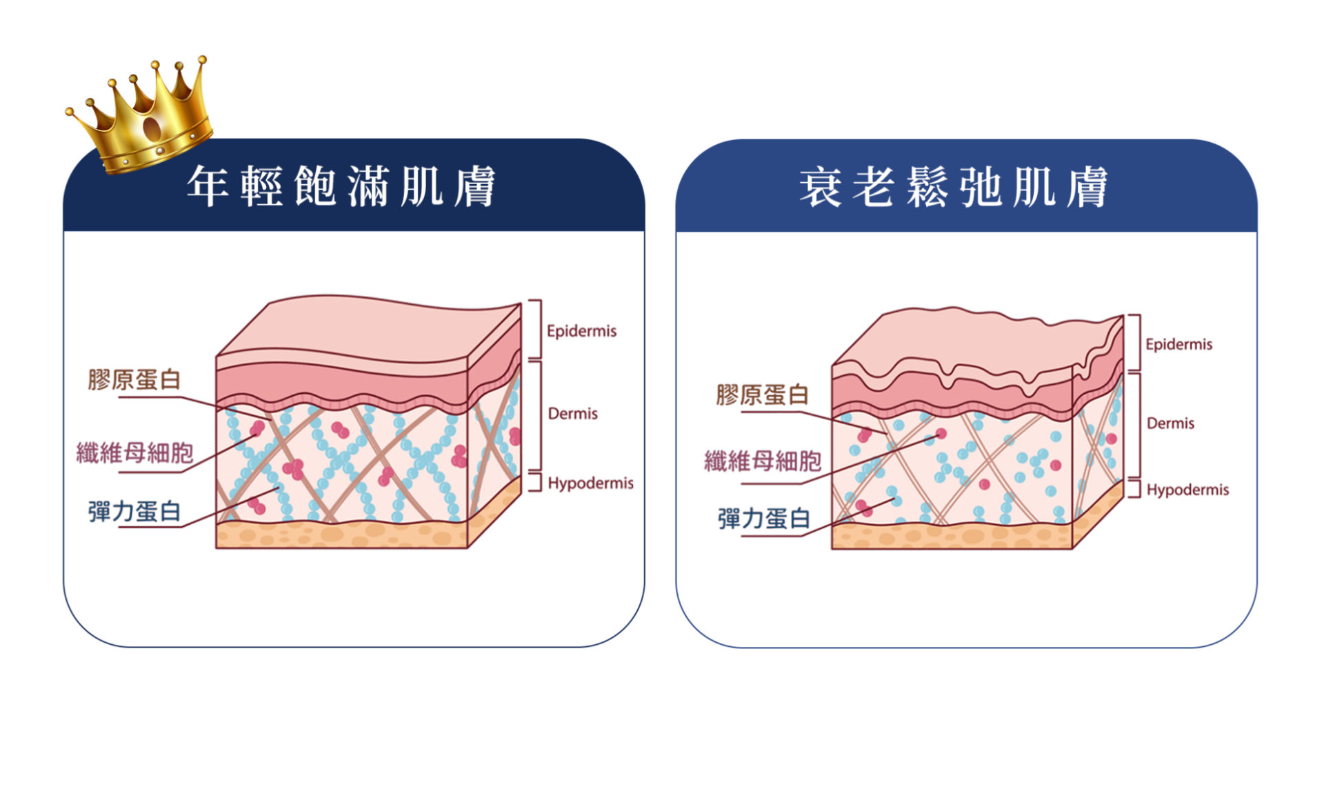 Profhilo 逆時針|核心原理
