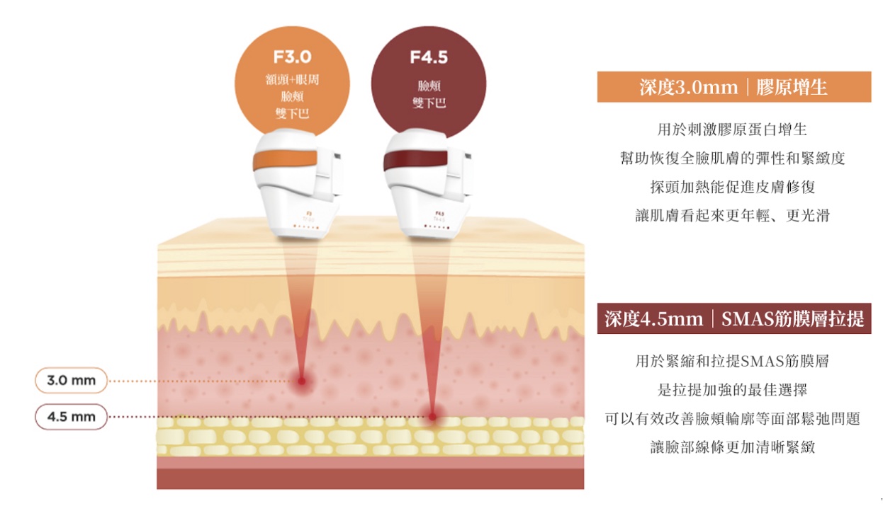 Tightan 咻音波｜探頭介紹