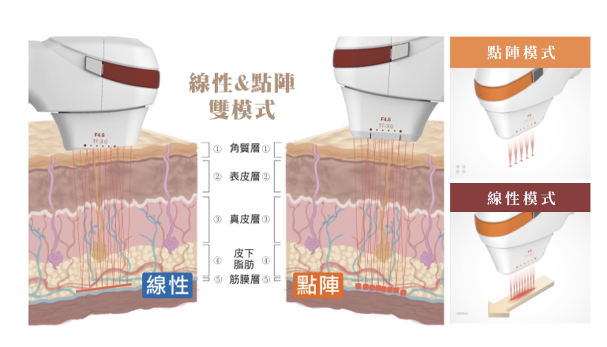 Tightan 咻音波｜線性＆點陣雙模式