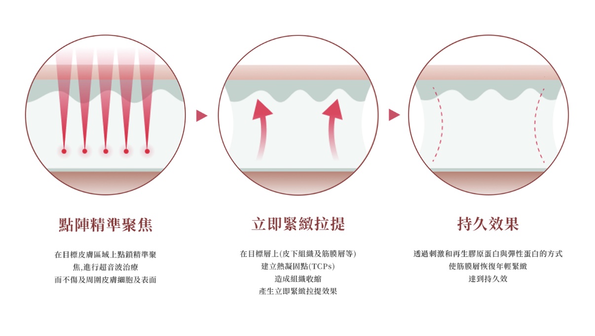 Tightan 咻音波｜核心原理