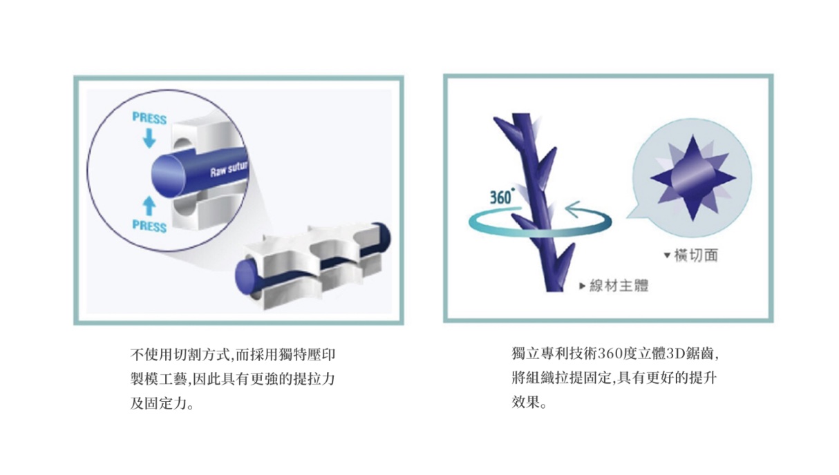 MINT秘特拉提線｜安全認證 &times; 全面拉提